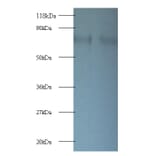40S ribosomal protein S10 Polyclonal Antibody from Signalway Antibody (42363) - Antibodies.com