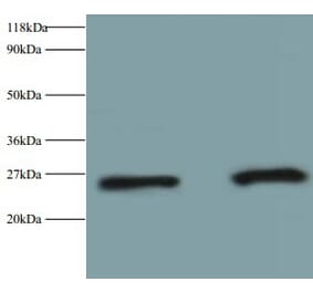 Retinol-binding protein 4 Polyclonal Antibody from Signalway Antibody (42475) - Antibodies.com