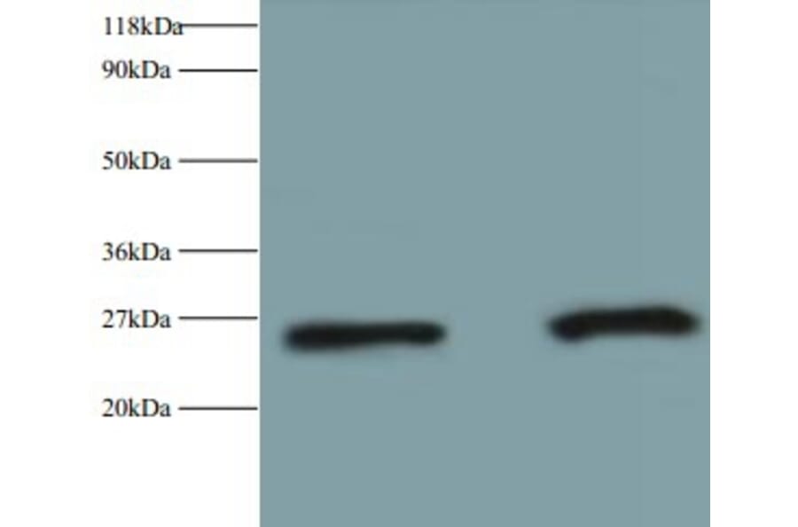 Retinol-binding protein 4 Polyclonal Antibody from Signalway Antibody (42475) - Antibodies.com