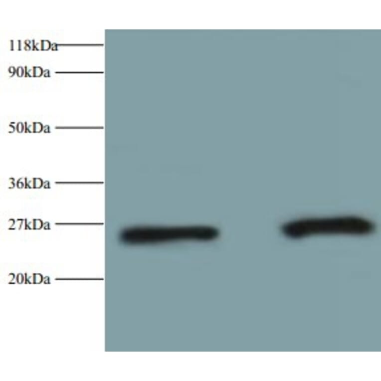 Retinol-binding protein 4 Polyclonal Antibody from Signalway Antibody (42475) - Antibodies.com