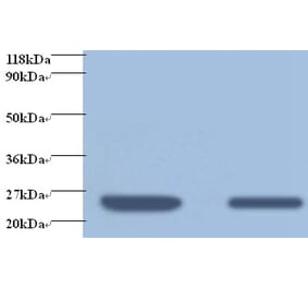 Retinol-binding protein 4 Polyclonal Antibody from Signalway Antibody (42476) - Antibodies.com