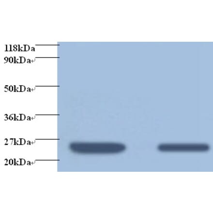 Retinol-binding protein 4 Polyclonal Antibody from Signalway Antibody (42476) - Antibodies.com