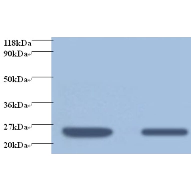 Retinol-binding protein 4 Polyclonal Antibody from Signalway Antibody (42476) - Antibodies.com