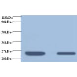 Retinol-binding protein 4 Polyclonal Antibody from Signalway Antibody (42476) - Antibodies.com