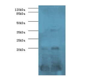 Serum amyloid A-1 protein Polyclonal Antibody from Signalway Antibody (42575) - Antibodies.com