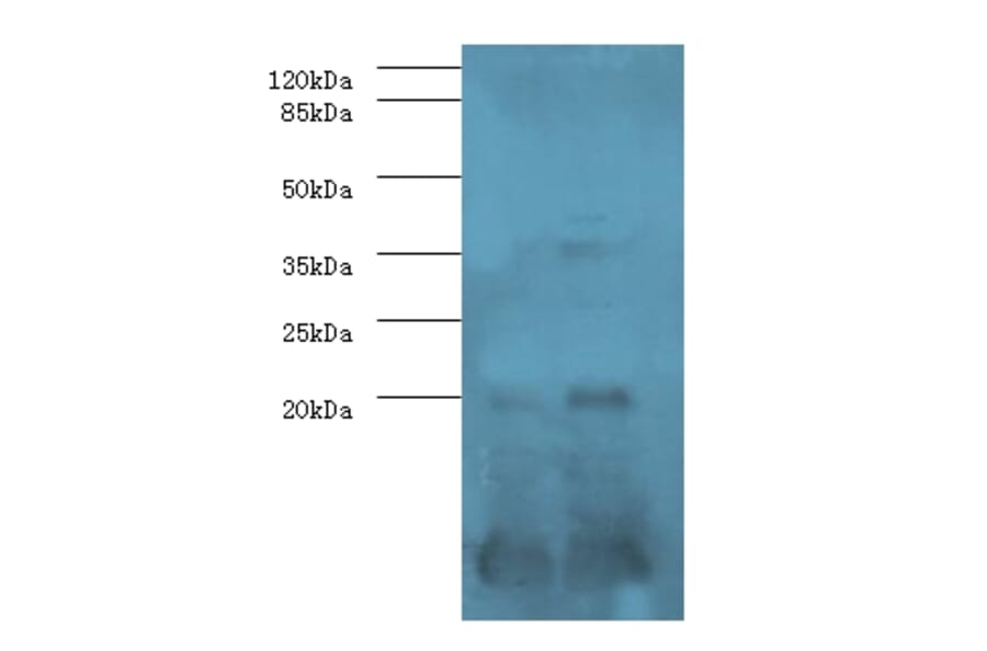 Serum amyloid A-1 protein Polyclonal Antibody from Signalway Antibody (42575) - Antibodies.com