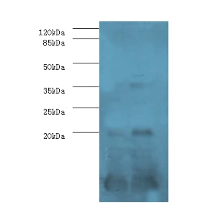 Serum amyloid A-1 protein Polyclonal Antibody from Signalway Antibody (42575) - Antibodies.com