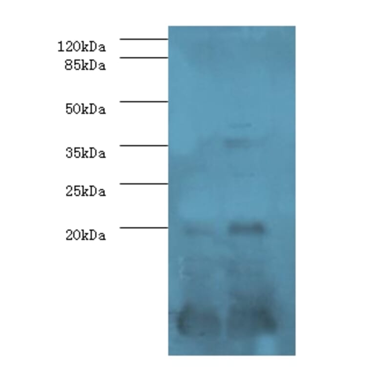 Serum amyloid A-1 protein Polyclonal Antibody from Signalway Antibody (42575) - Antibodies.com