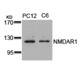 Western blot - NMDAR1 (Ab-896) Antibody from Signalway Antibody (21133) - Antibodies.com