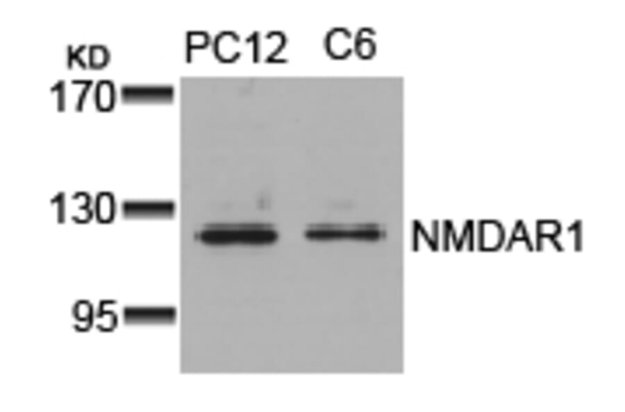 Western blot - NMDAR1 (Ab-896) Antibody from Signalway Antibody (21133) - Antibodies.com