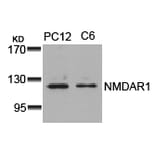 Western blot - NMDAR1 (Ab-896) Antibody from Signalway Antibody (21133) - Antibodies.com