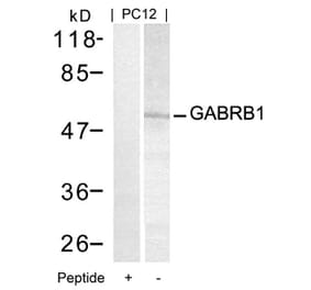 Western blot - GABRB1 (Ab-434) Antibody from Signalway Antibody (21205) - Antibodies.com
