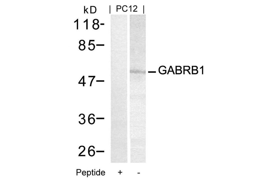 Western blot - GABRB1 (Ab-434) Antibody from Signalway Antibody (21205) - Antibodies.com