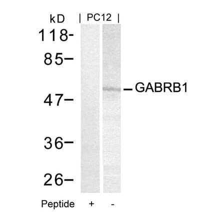 Western blot - GABRB1 (Ab-434) Antibody from Signalway Antibody (21205) - Antibodies.com
