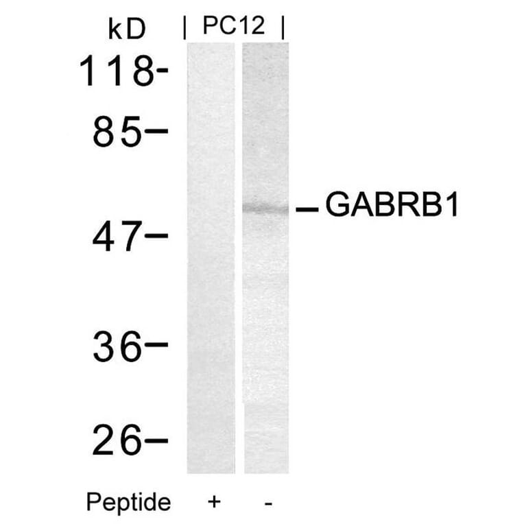 Western blot - GABRB1 (Ab-434) Antibody from Signalway Antibody (21205) - Antibodies.com