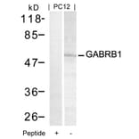 Western blot - GABRB1 (Ab-434) Antibody from Signalway Antibody (21205) - Antibodies.com