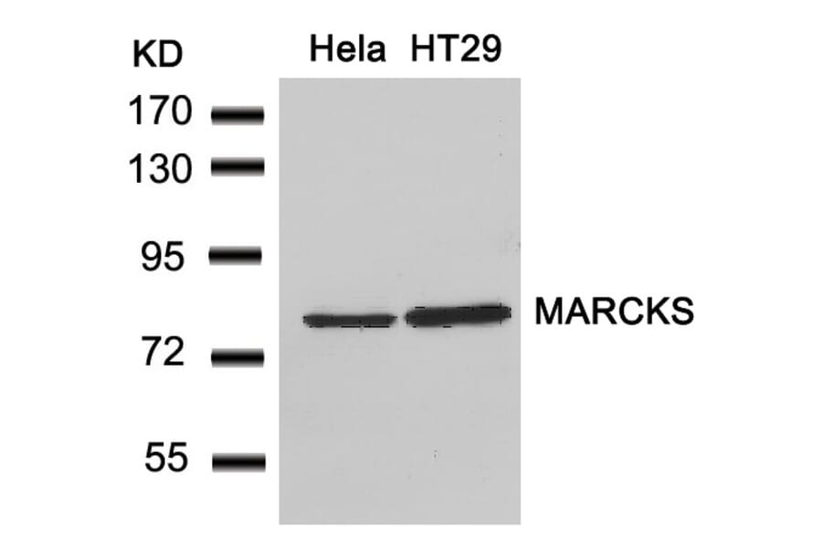 Western blot - MARCKS (Ab-162) Antibody from Signalway Antibody (21257) - Antibodies.com