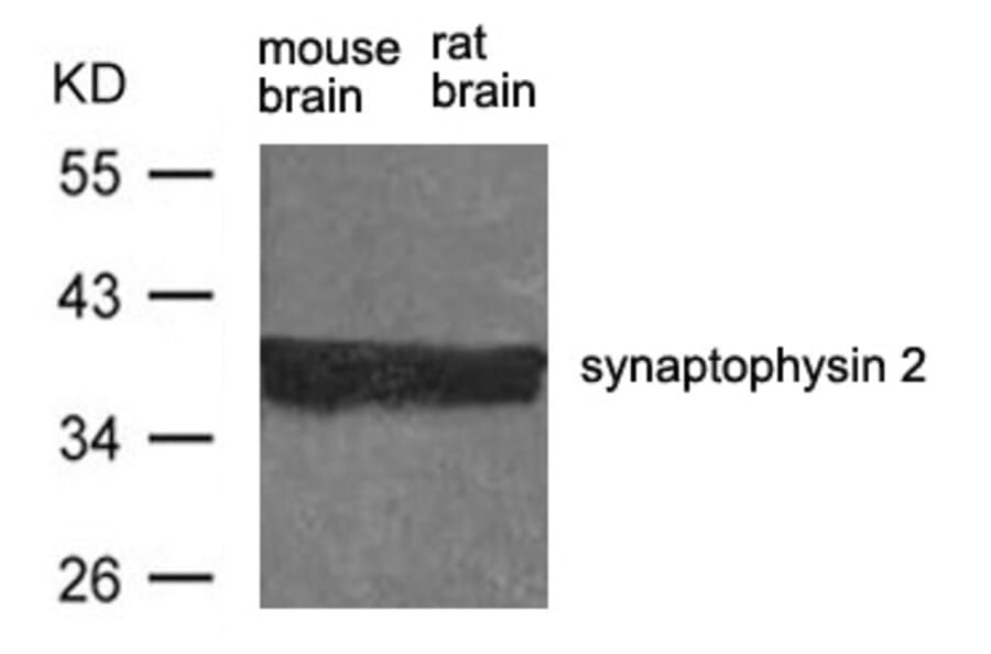 Western blot - synaptophysin 2 Antibody from Signalway Antibody (21452) - Antibodies.com