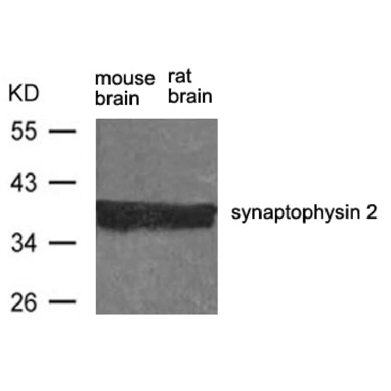 Western blot - synaptophysin 2 Antibody from Signalway Antibody (21452) - Antibodies.com