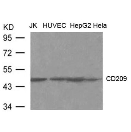 Western blot - CD209 (DC-SIGN) Antibody from Signalway Antibody (21600) - Antibodies.com