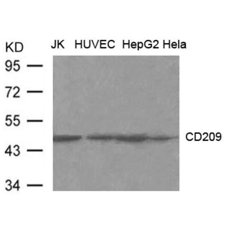 Western blot - CD209 (DC-SIGN) Antibody from Signalway Antibody (21600) - Antibodies.com