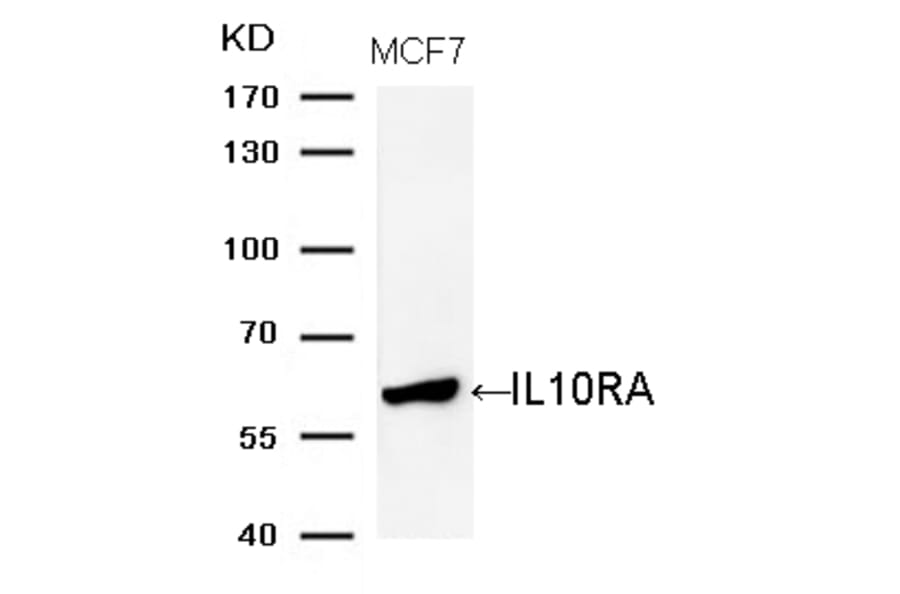 Western blot - IL10RA (Ab-370) Antibody from Signalway Antibody (21697) - Antibodies.com