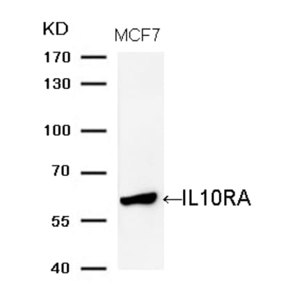 Western blot - IL10RA (Ab-370) Antibody from Signalway Antibody (21697) - Antibodies.com