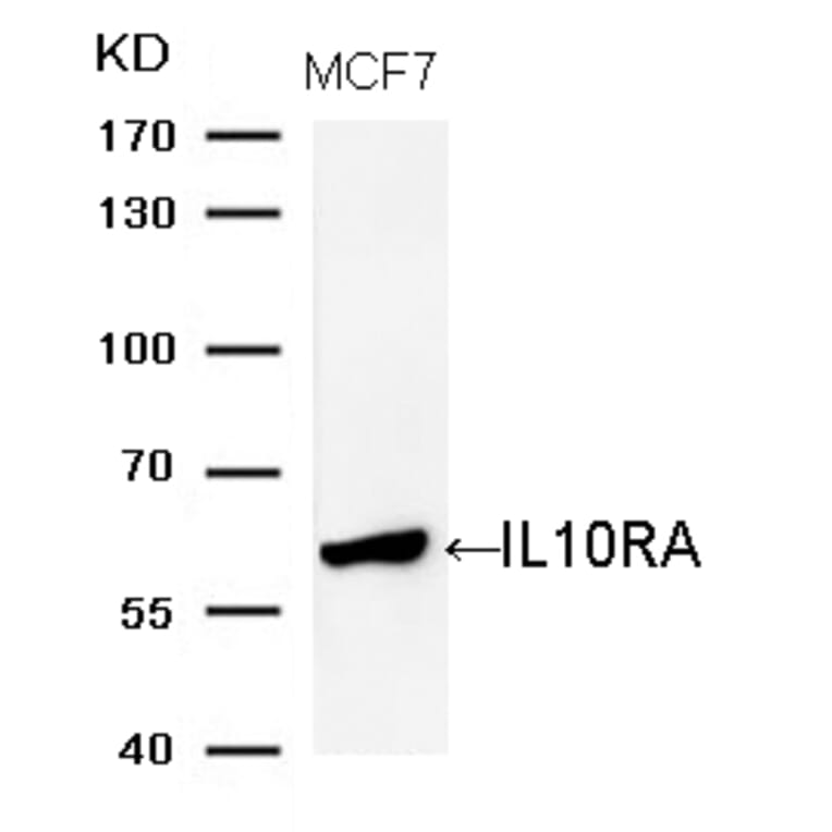 Western blot - IL10RA (Ab-370) Antibody from Signalway Antibody (21697) - Antibodies.com