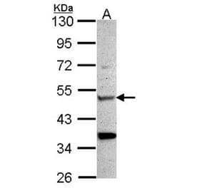 Chitotriosidase antibody from Signalway Antibody (22163) - Antibodies.com