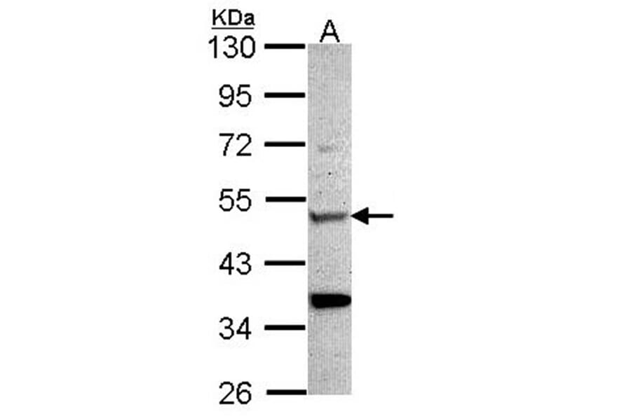 Chitotriosidase antibody from Signalway Antibody (22163) - Antibodies.com