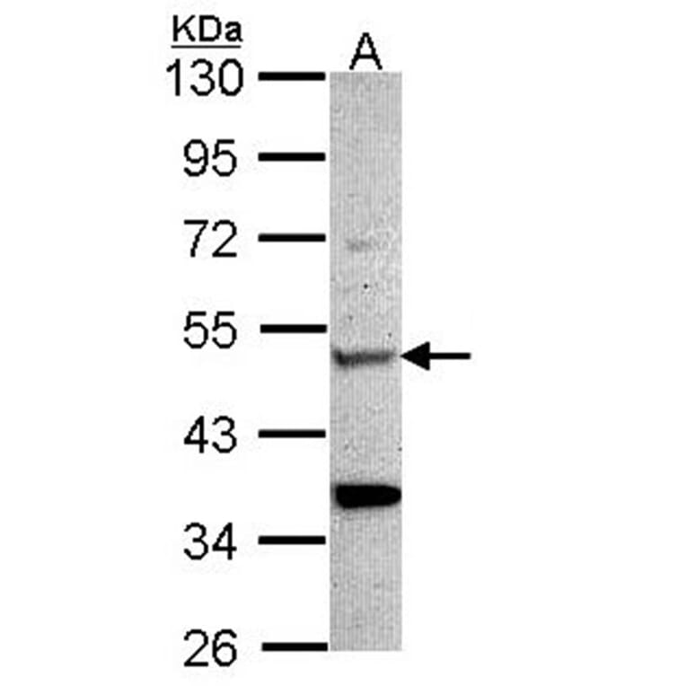 Chitotriosidase antibody from Signalway Antibody (22163) - Antibodies.com