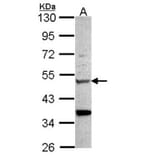 Chitotriosidase antibody from Signalway Antibody (22163) - Antibodies.com