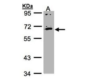 IL17 receptor C antibody from Signalway Antibody (22229) - Antibodies.com