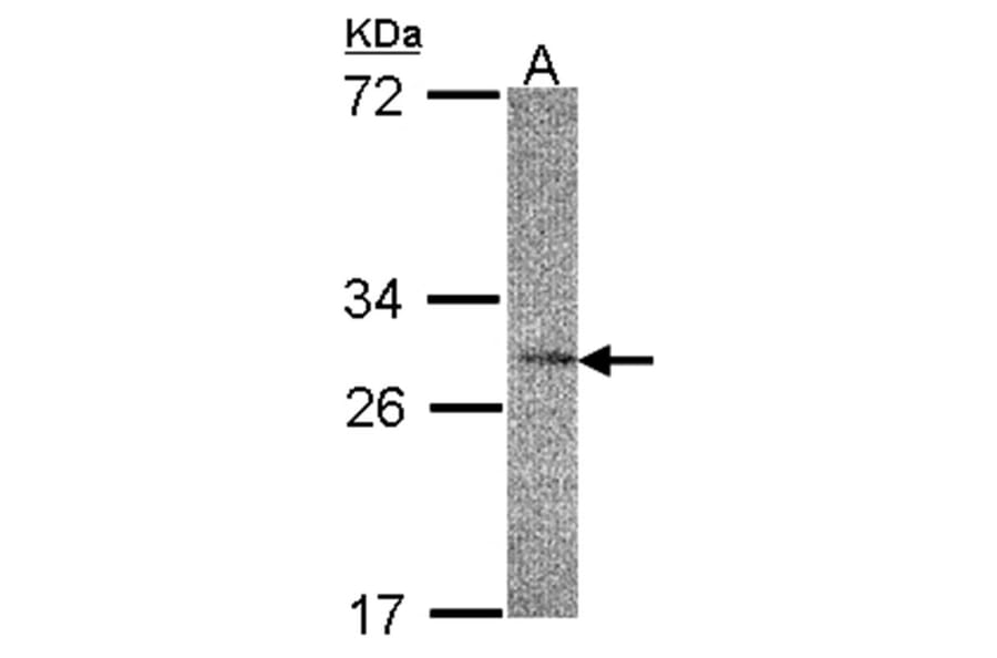 IL-22R alpha 2 antibody from Signalway Antibody (22453) - Antibodies.com