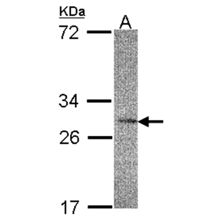 IL-22R alpha 2 antibody from Signalway Antibody (22453) - Antibodies.com