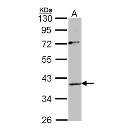 Apelin receptor antibody from Signalway Antibody (22823) - Antibodies.com