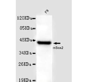 SOX2 Monoclonal Antibody from Signalway Antibody (27015) - Antibodies.com