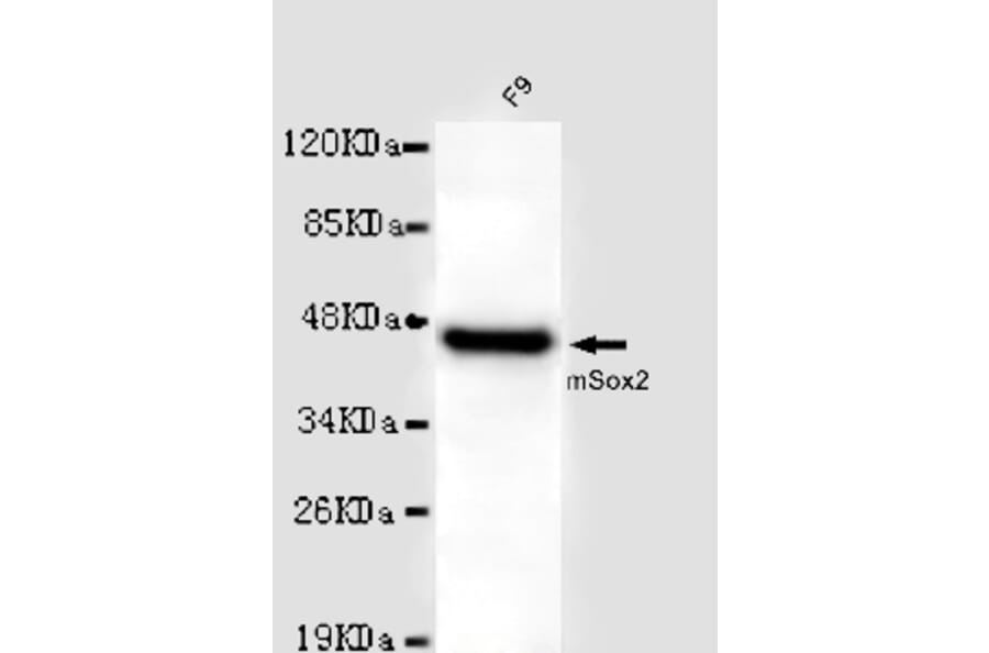 SOX2 Monoclonal Antibody from Signalway Antibody (27015) - Antibodies.com