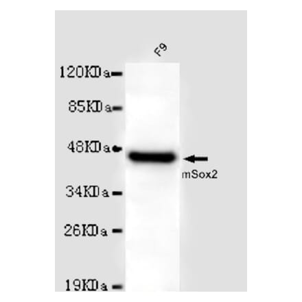 SOX2 Monoclonal Antibody from Signalway Antibody (27015) - Antibodies.com