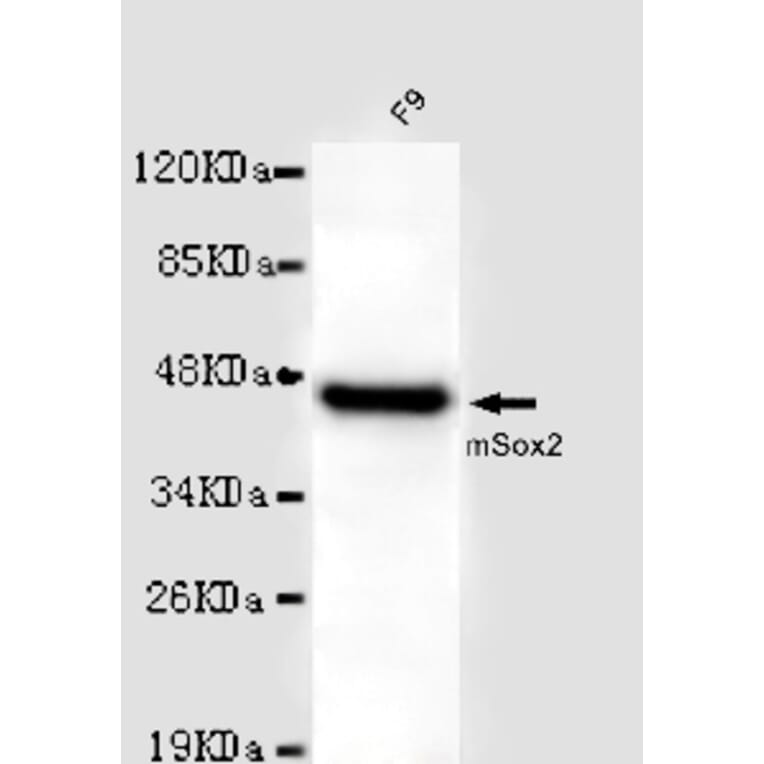 SOX2 Monoclonal Antibody from Signalway Antibody (27015) - Antibodies.com