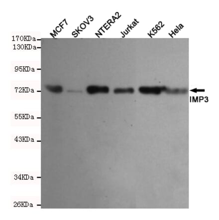 Western blot - IMP3 Monoclonal Antibody from Signalway Antibody (27206) - Antibodies.com