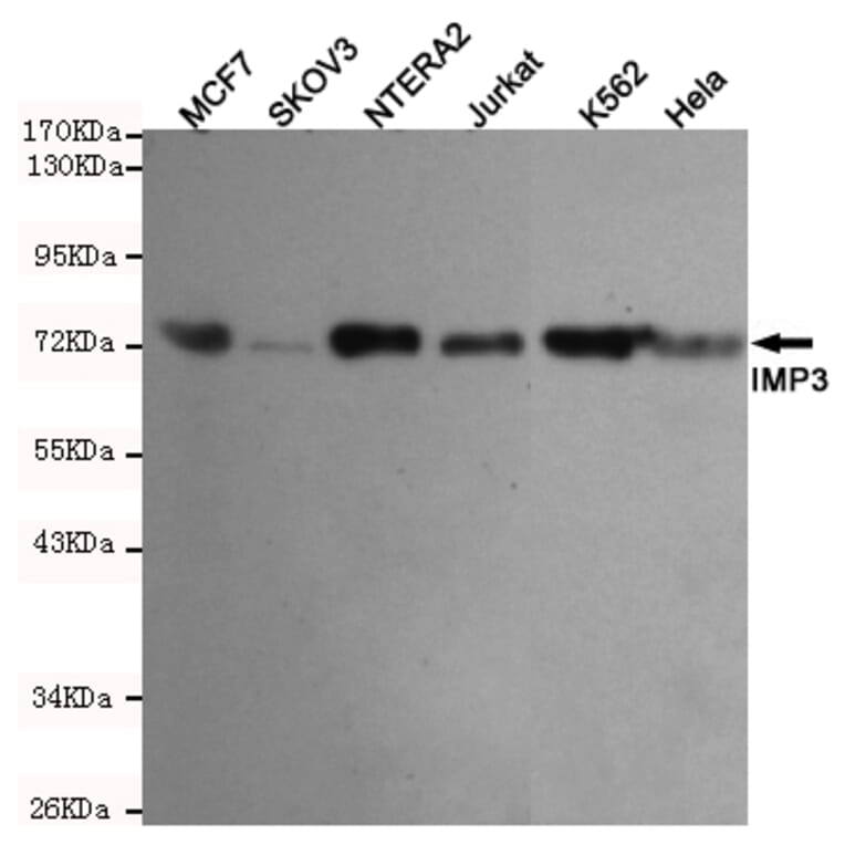 Western blot - IMP3 Monoclonal Antibody from Signalway Antibody (27206) - Antibodies.com