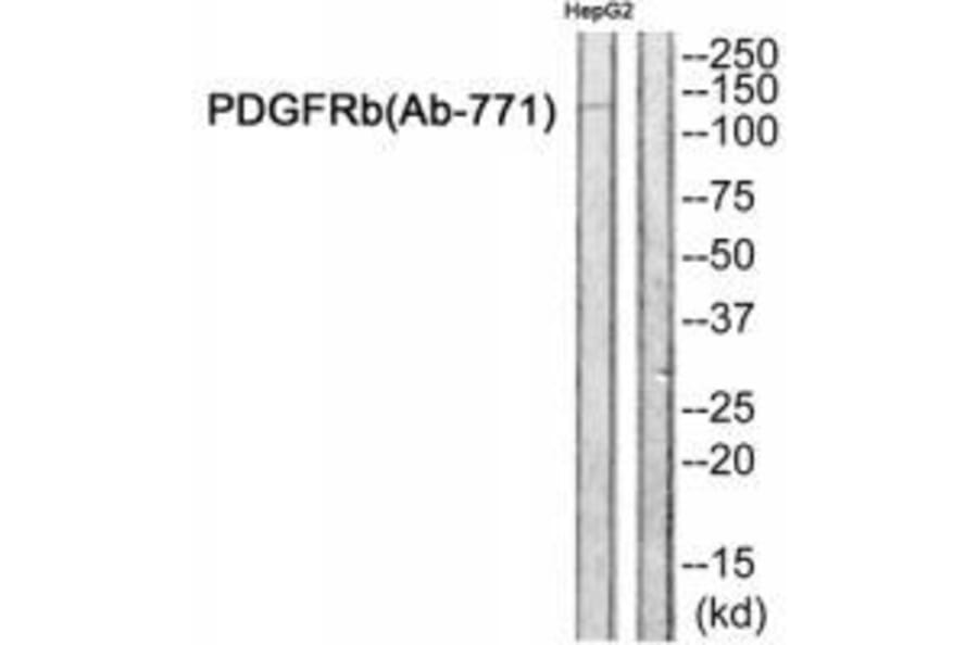 Western blot - PDGFRb (Ab-771) Antibody from Signalway Antibody (33246) - Antibodies.com