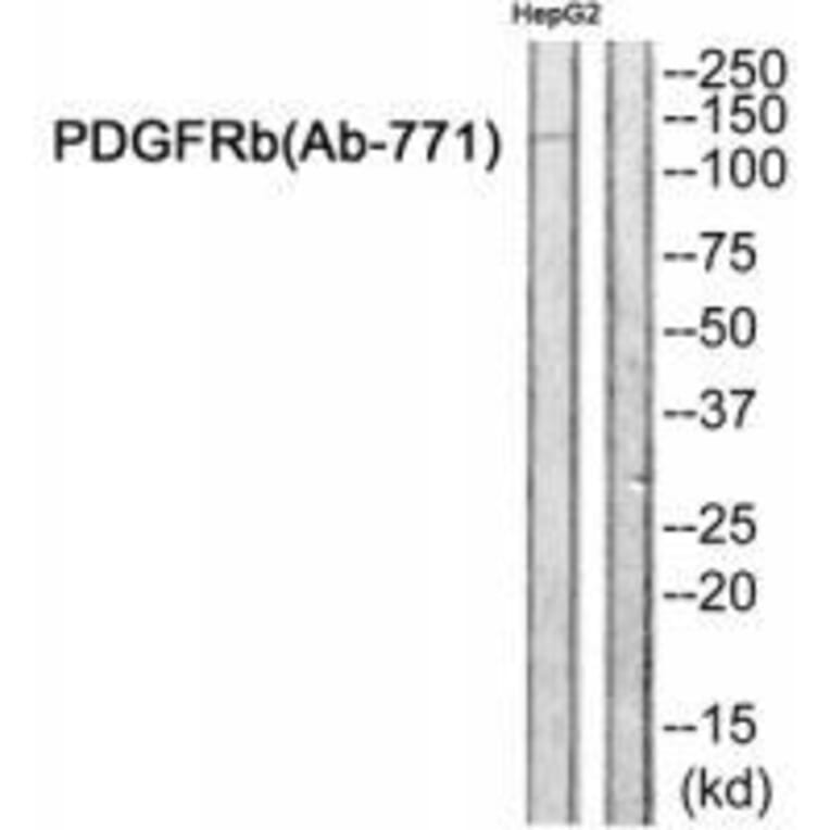 Western blot - PDGFRb (Ab-771) Antibody from Signalway Antibody (33246) - Antibodies.com