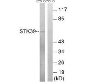 Western blot - STK39 (Ab-325) Antibody from Signalway Antibody (33250) - Antibodies.com