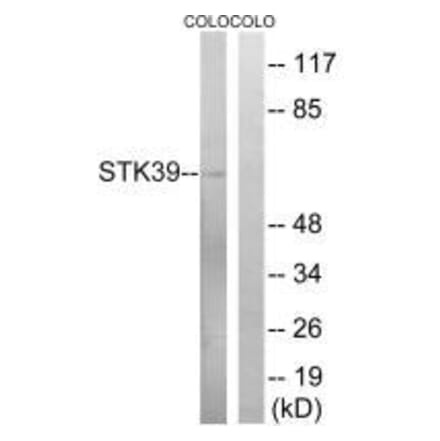 Western blot - STK39 (Ab-325) Antibody from Signalway Antibody (33250) - Antibodies.com