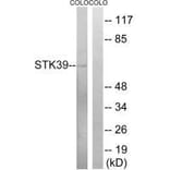 Western blot - STK39 (Ab-325) Antibody from Signalway Antibody (33250) - Antibodies.com