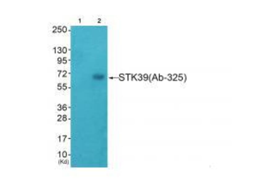 Western blot - STK39 (Ab-325) Antibody from Signalway Antibody (33250) - Antibodies.com