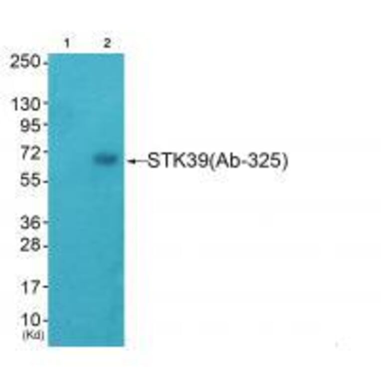 Western blot - STK39 (Ab-325) Antibody from Signalway Antibody (33250) - Antibodies.com