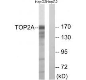 Western blot - TOP2A (Ab-1343) Antibody from Signalway Antibody (33258) - Antibodies.com